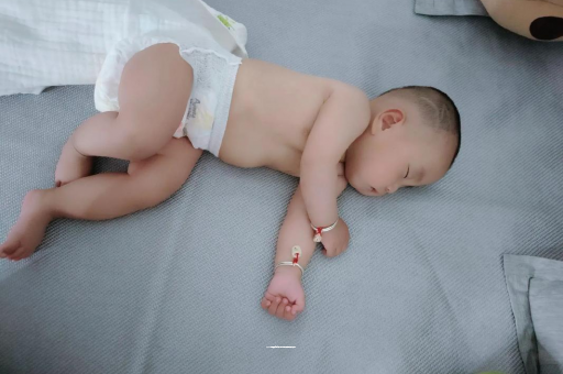 舞钢六个月宝宝眼睛散光
